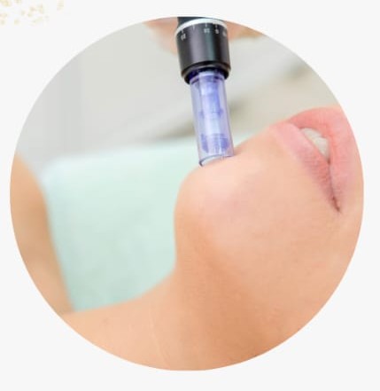 Dermapen